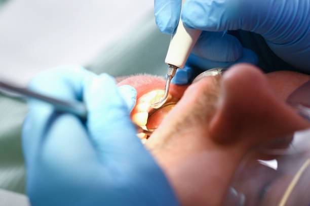 Best Urgent Tooth Repair  in Robie Creek, ID
