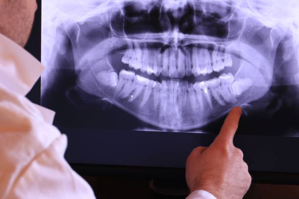 Best Broken Tooth Emergency  in Robie Creek, ID